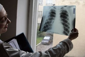 У вчительки львівської школи діагностували відкриту форму туберкульозу