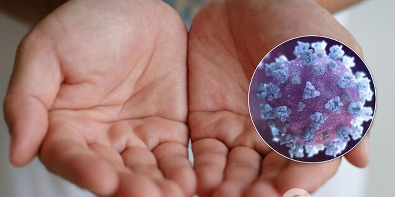 Уничтожает генматериал коронавируса! Ученые выяснили уникальные свойства простого гигиенического средства