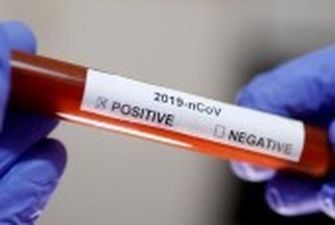 На Буковині виявили 22 нові випадки коронавірусу за добу