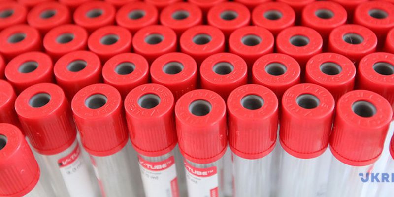 В Украине зафиксировали 756 новых случаев коронавируса