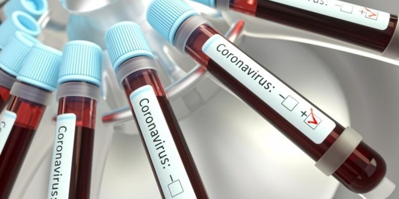 В Украине - 4 984 новых случая коронавируса