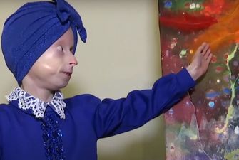 "Ее сердце остановилось": умерла единственная в Украине девочка с синдромом преждевременного старения