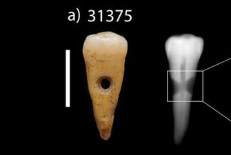 В Турции найдены древние украшения из человеческих зубов