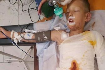 В Днепре дети подожгли 8-летнего мальчика: первые детали