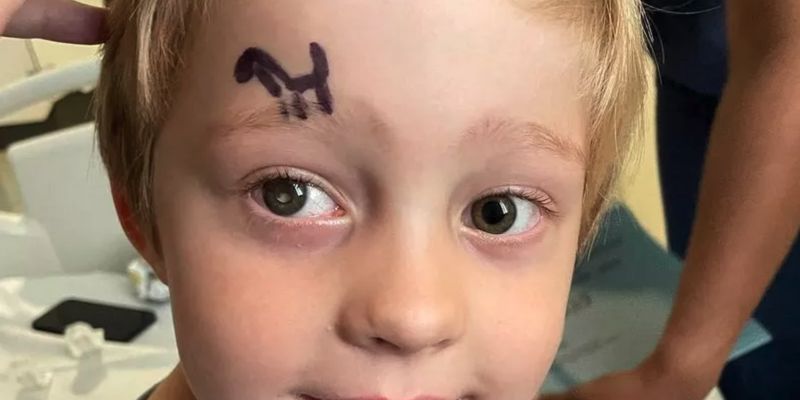 Глаза светились белым: 5-летнего мальчика поразила редкая болезнь