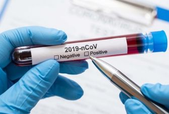 Вот в чем причина: врач объяснила, почему вакцинированные украинцы заражаются коронавирусом