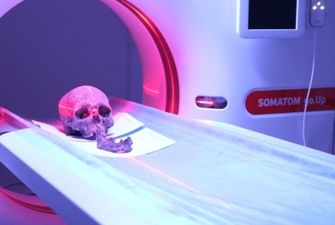 Принадлежал 25-летнему мужчине: в Тернополе археологи сканировали череп, которому три тысячи лет
