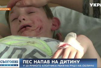 В Тернополе собака вцепилась в лицо девятилетнего ребенка
