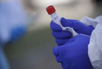 Скандали через тестування на коронавірус: чому ПЛР-аналізи можуть давати хибний результат