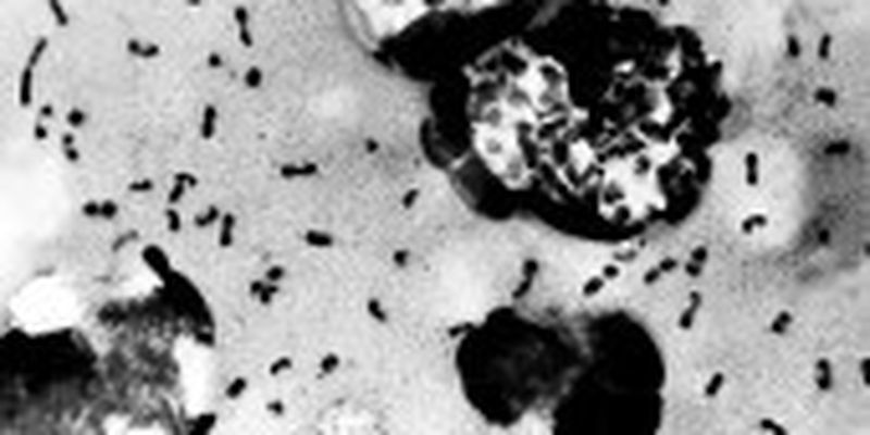Китай повідомив про випадок зараження людини бубонною чумою