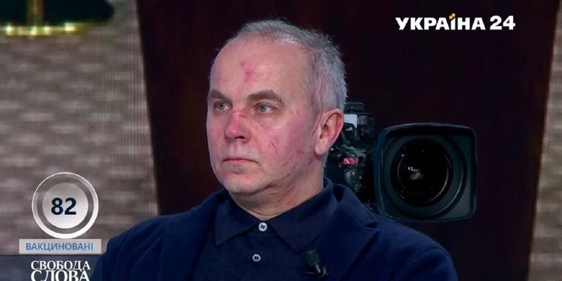 Шуфрича снова избили: как соцсети реагировали на конфликт Бутусова и члена ОПЗЖ