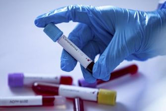 Украина получит новые тесты для выявления коронавируса — их можно использовать без лабораторий