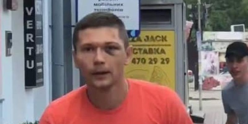 Танцора Дорофеевой избил сотрудник госохраны