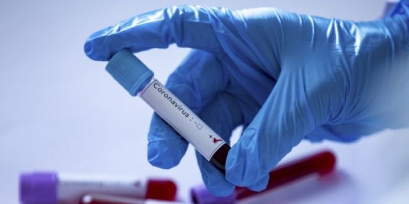 Украина получит новые тесты для выявления коронавируса — их можно использовать без лабораторий