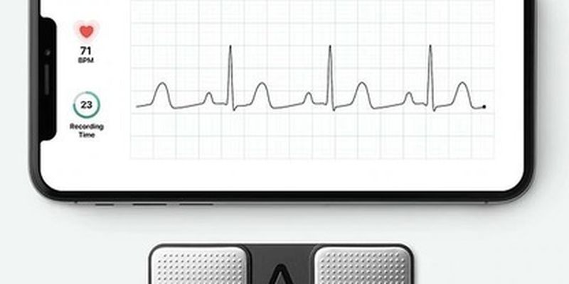 Сердечники смогут снимать ЭКГ дома на смартфонах: как это работает