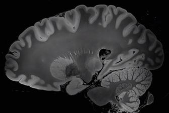 МРТ на 100 часов: ученые получили самые подробные изображения мозга человека