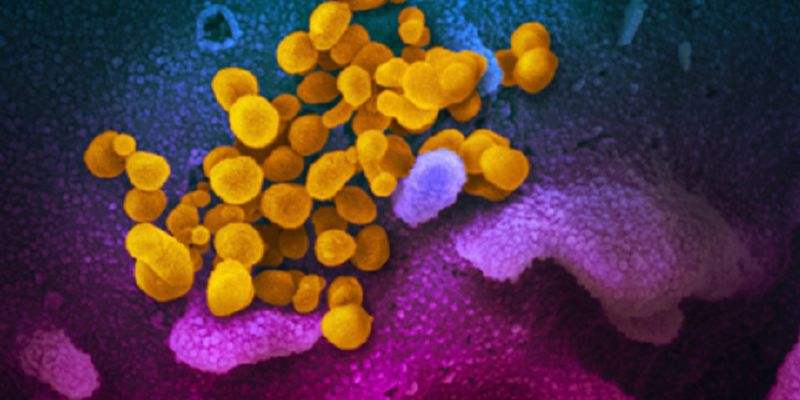 «Ефект матового скла»: у людей, які безсимптомно хворіли коронавірусом, виявили ураження легень