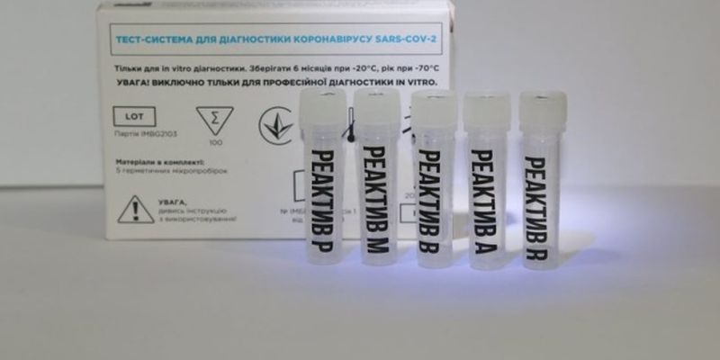 В Украине разработали тест для одновременного определения COVID-19 и двух штаммов гриппа