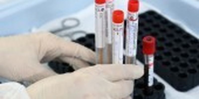 Для в’їзду в Україну негативний ПЛР-тест на коронавірус повинні мати усі іноземці – ДПСУ