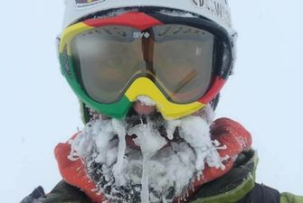"Мій писок на 22-й годині пошуків": гірський гід показав, як обморозив лице, шукаючи туриста на Закарпатті