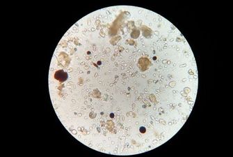 Ученые обнаружили микроорганизмы, которые старше самой Земли