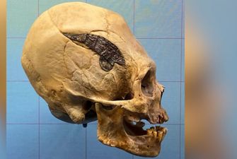 Археологи нашли следы самой первой операции в мире на черепе возрастом 2 тыс. лет