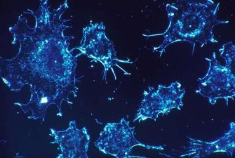 Боротьба з раком: науковці заговорили про "універсальний спосіб"