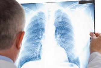 Ежегодно 4 тысячи украинцев умирают от туберкулеза