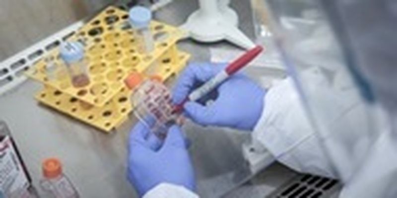 Вспышка гепатита в Виннице: 141 пациент в больнице