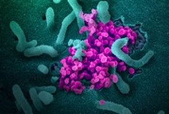 Атака коронавируса под микроскопом: фотогалерея