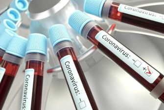 У шести прихожан церкви из Радомышля обнаружили коронавирус