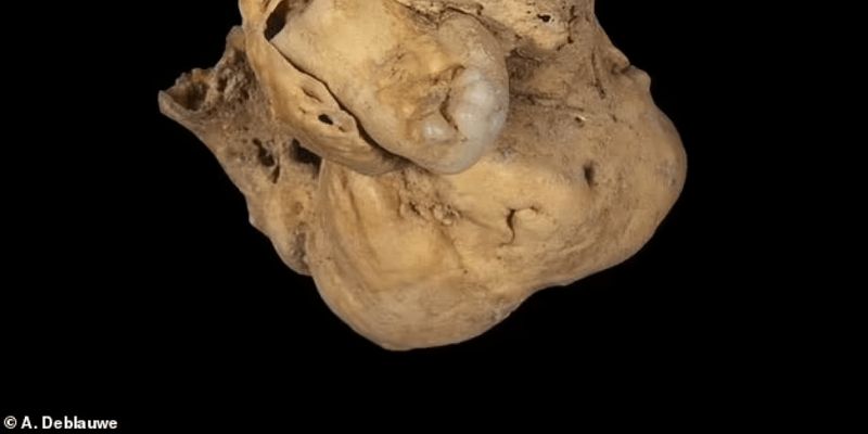 Жуткая находка: в гробнице нашли опухоль яичника с зубами, которой 3 тысячи лет, фото