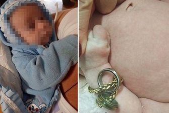 Под Днепром обнаружили необычного новорожденного с кольцами