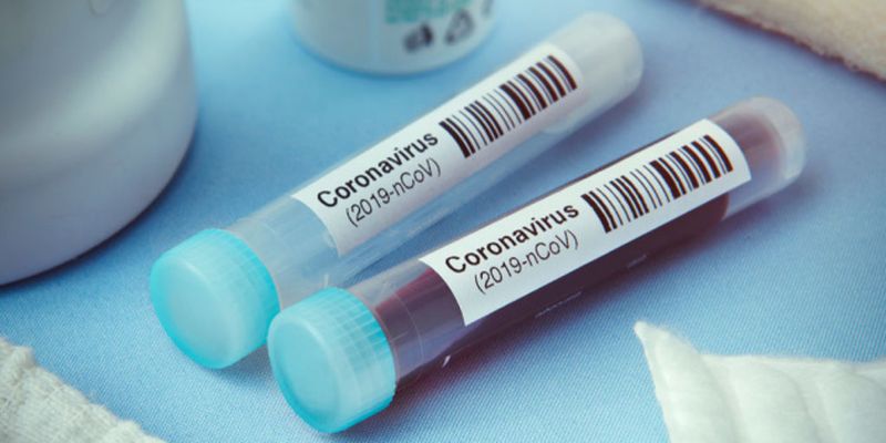 В Украине - 2 266 новых случаев коронавируса