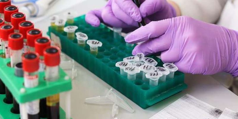 На Буковині за добу зафіксували 139 випадки коронавірусу