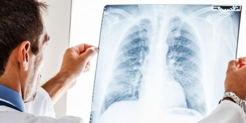 В Украине обновили стандарты медпомощи больным туберкулезом