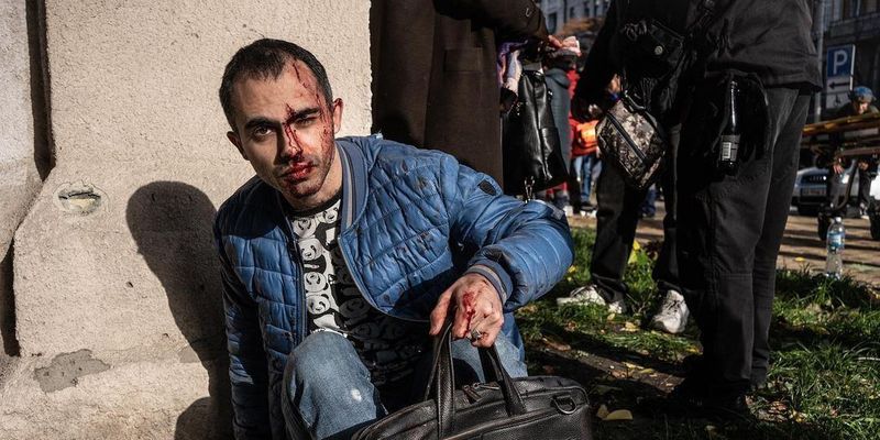 В больницах до сих пор находится 35 киевлян, пострадавших от обстрела 10 октября, – Кличко