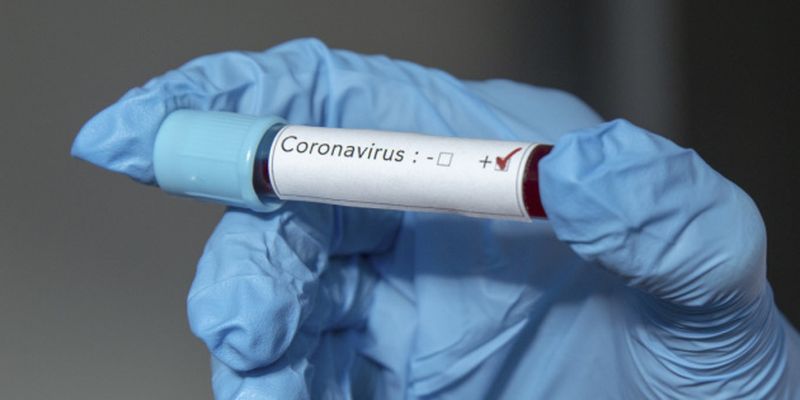 В Калифорнии зафиксировали второй случай заражения коронавирусом — WP