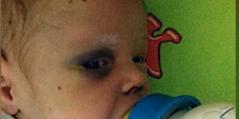 В Ровно горе-мать жестоко избила малыша: СМИ узнали о состоянии ребенка