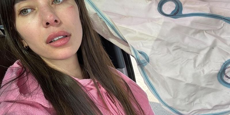 Ударило сильно по лицу: "Мисс Украина Вселенная" Анна Неплях попала в серьезное ДТП/Сработали подушки безопасности
