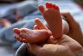 Жуткие кадры: в Индии родился ребенок с 4 ногами
