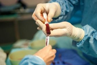 Минздрав планирует до конца года провести почти 130 трансплантаций