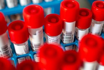В Польше коронавирусом заразился 461 медик