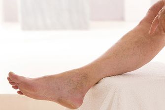 «Крутит ноги?»: как устранить боли и снять симптомы