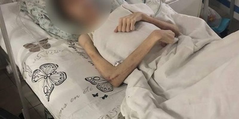 В Одессе отец устроил больному сыну "духовное лечение" - врачи спасают мальчику жизнь: фото