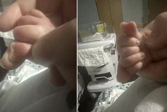 Врачи никогда такого не видели: в США родился мальчик с большим пальцем в форме сердца. Фото
