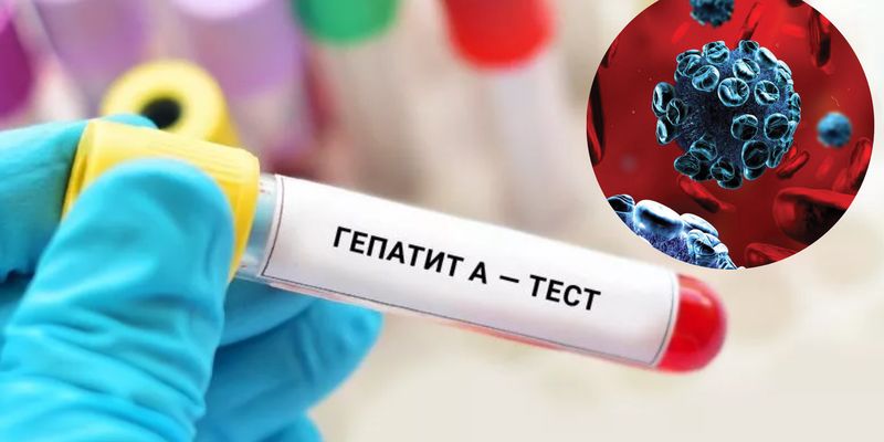 Количество больных увеличилось в разы: что известно о вспышке гепатита А в Украине