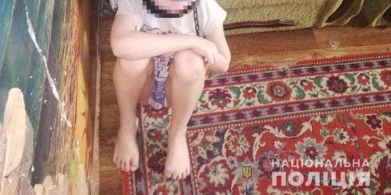 В Днепре мальчика дома держали на цепи: фото и детали жуткой истории
