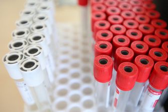 На Олимпиаде обнаружили 148 больных с коронавирусом