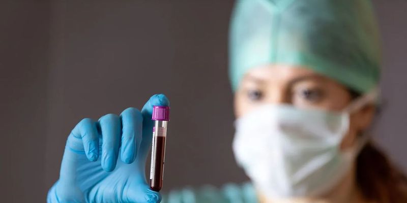Визначає рак підшлункової залози з точністю 97%: учені представили новий аналіз крові